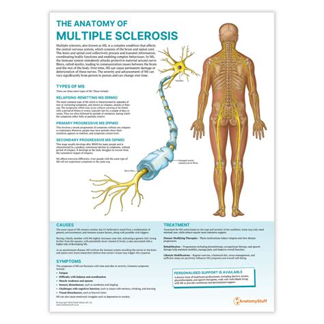 An Overview Of Multiple Sclerosis
