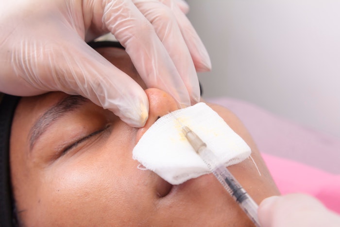 Cultural Identity Is Taking Center Stage In Rhinoplasty And Surgeons Are Listening Medesthetics