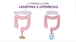 Lazy Bowel Syndrome What Is It Causes Treatment And More Osmosis