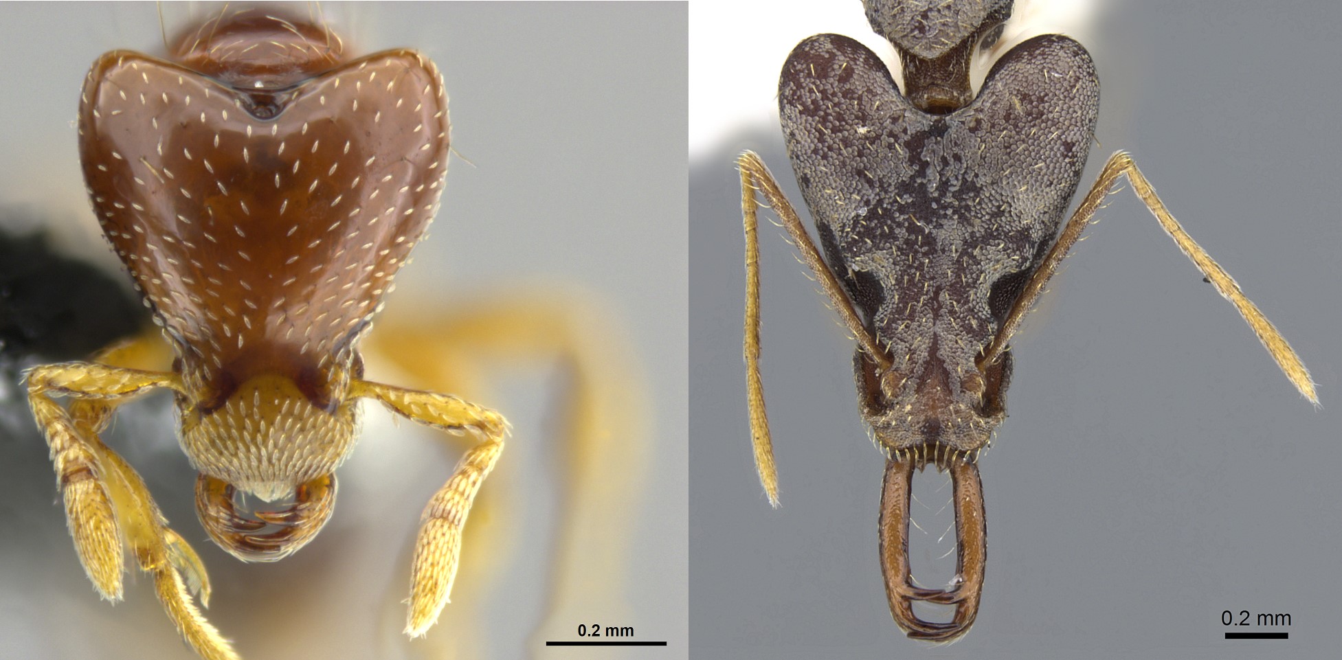 Length Of Mandible: Causes, Symptoms, And Treatments