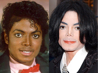 Michael Jackson Plastic Surgery: History, Rumors, And Impact