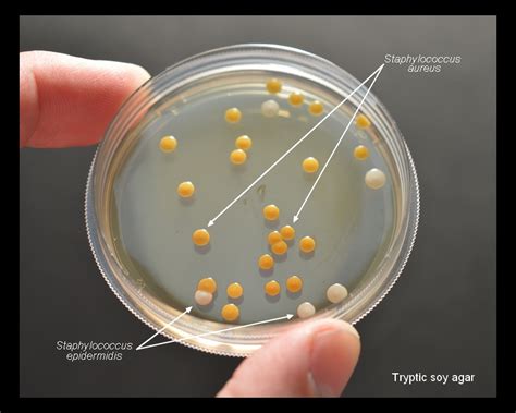 Staphylococcus Epidermidis Agar Staphylococcus Epidermidis Agar