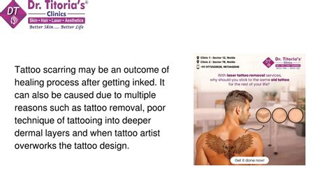 Tattoo Scarring Can I Treat Or Remove Unwanted Tattoo Scars