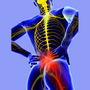 Avoiding Common Mistakes With Vitamins For Sciatica Pain