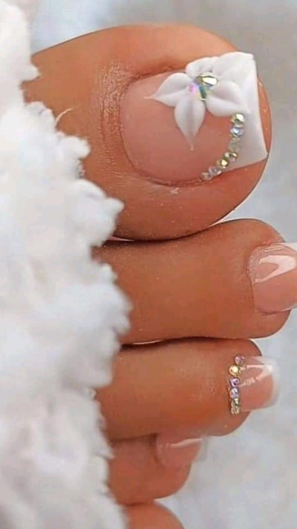 White Toe Nails: Restore Shine, Health, And Confidence